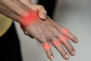 Person holding wrist with thumb on back of hand. There is red color over knuckles.